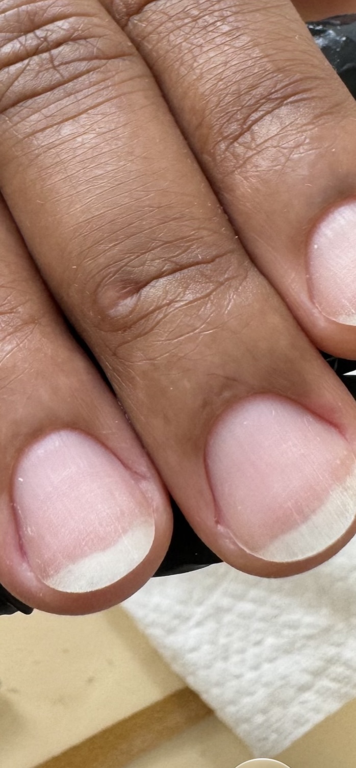 Remoção esmalte em gel